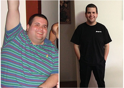 Damien’s Gastric Sleeve